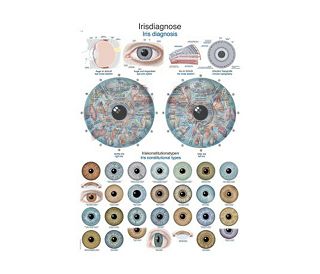 DIJAGNOZA ŠARENICE, ANATOMSKI POSTER, 50 X 70 cm, plastificirani