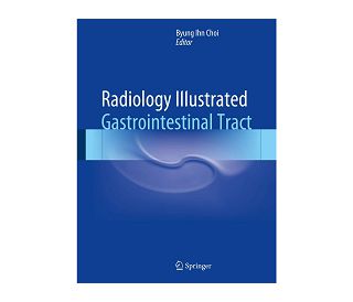 RADIOLOGY ILLUSTRATED: GASTROINTESTINAL TRACT, Byung Ihn Choi